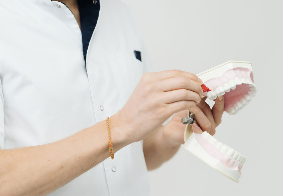 Porcelain Veneers