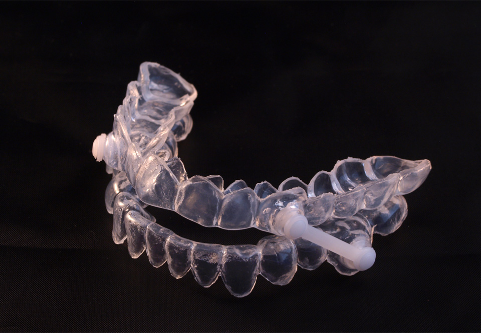 Sleep Apnea Appliances