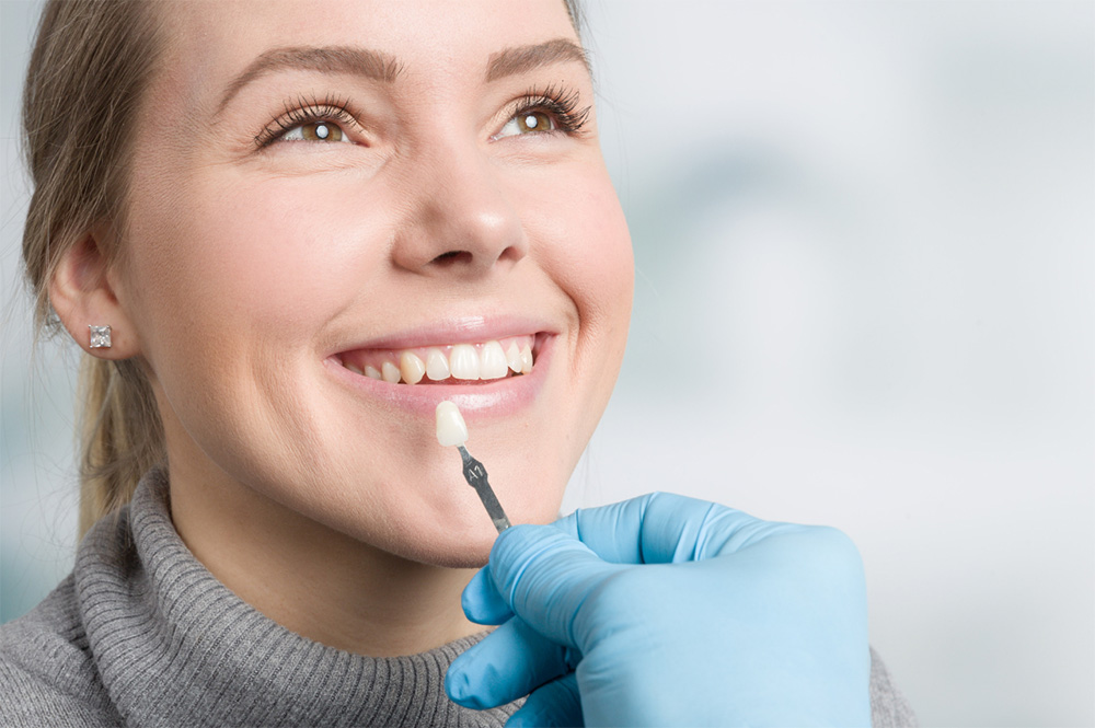 Porcelain Veneers