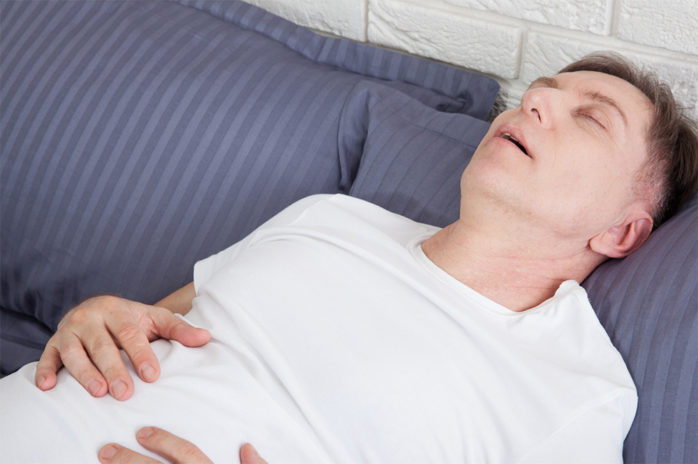 Sleep Apnea Appliances