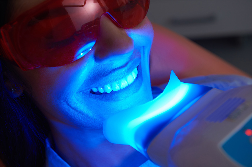 Teeth Whitening