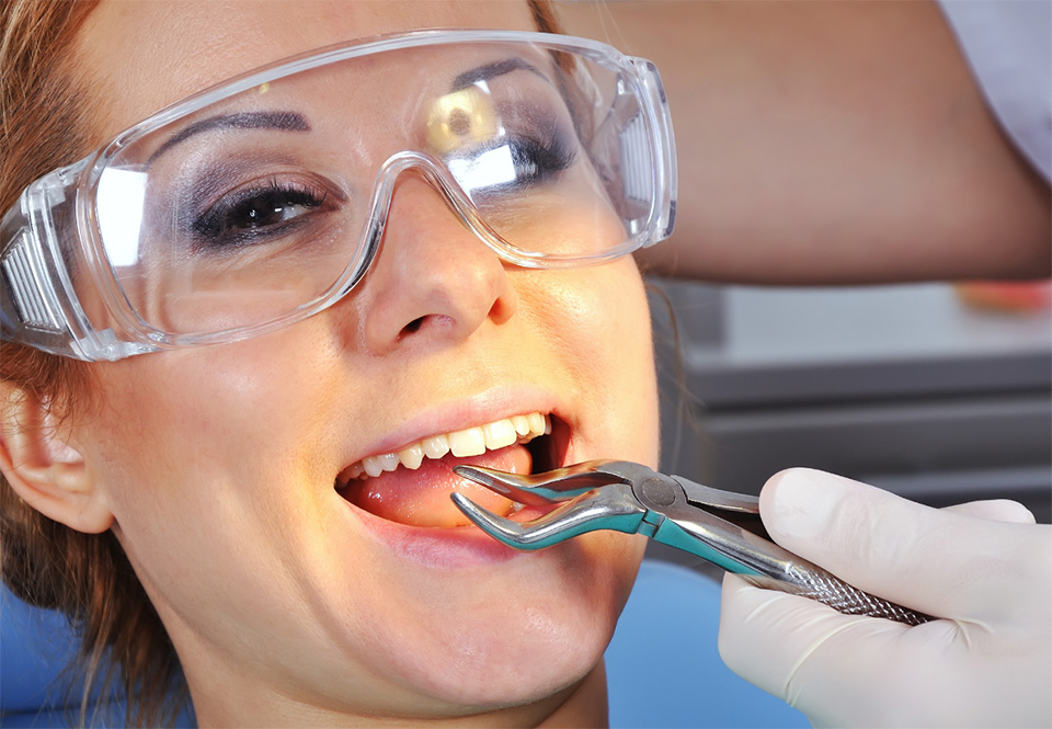 Tooth Extraction